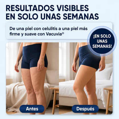 Vacuvia® SculptGlow™ Piel más Firme y Tonificada (Copia)